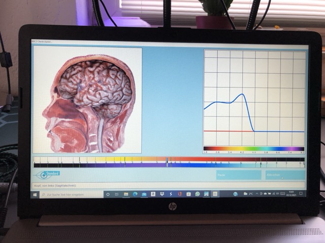Bicom BodyCheck2 - Bild 4