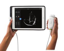 Philips Lumify S4-1 Breitband-Sektor-Schallkopf