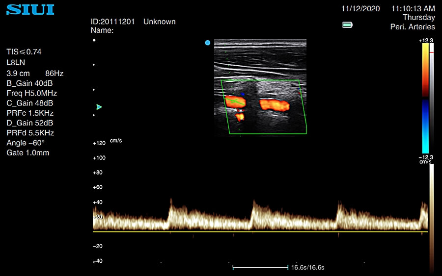 Mobile Ultraschallgeräte SIUI Apogee 2100 - Bild 3
