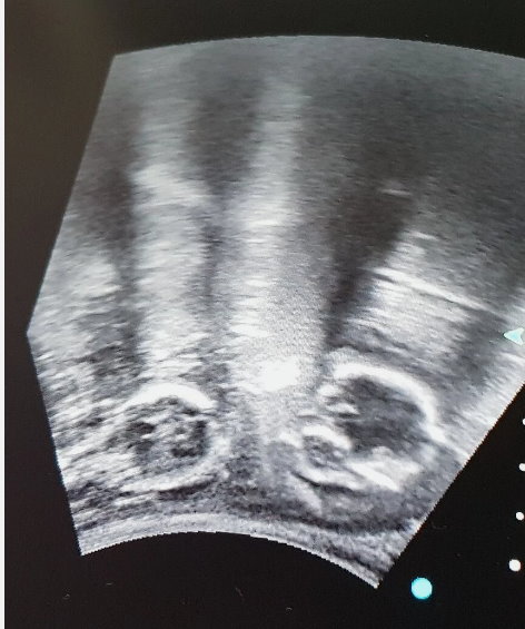 Mobile Ultraschallgeräte SIUI Apogee 2100  - Bild 4