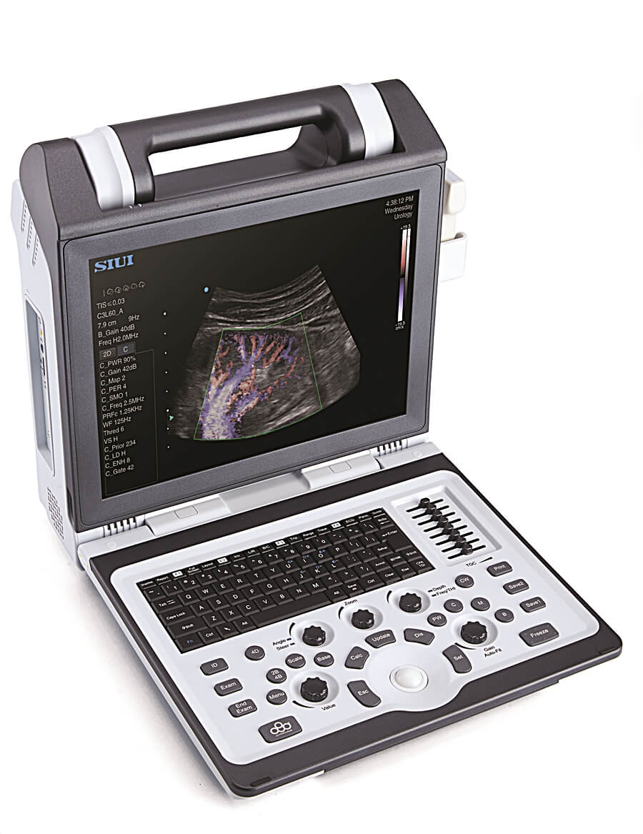 Mobile Ultraschallgeräte SIUI Apogee 2100