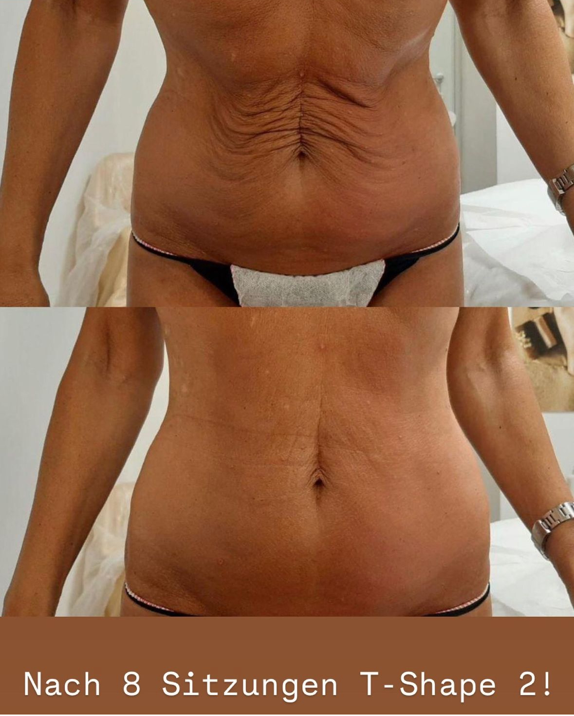 T-SHAPE 2 by BALDAN 5in1 WUNDER - NP -80000€!  - Bild 2