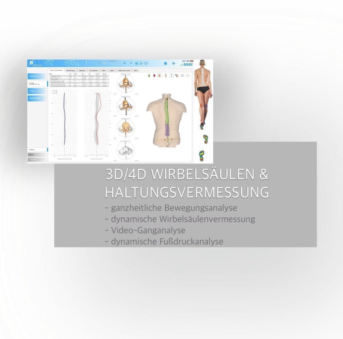 4D Wirbelsäulenvermessung Diers