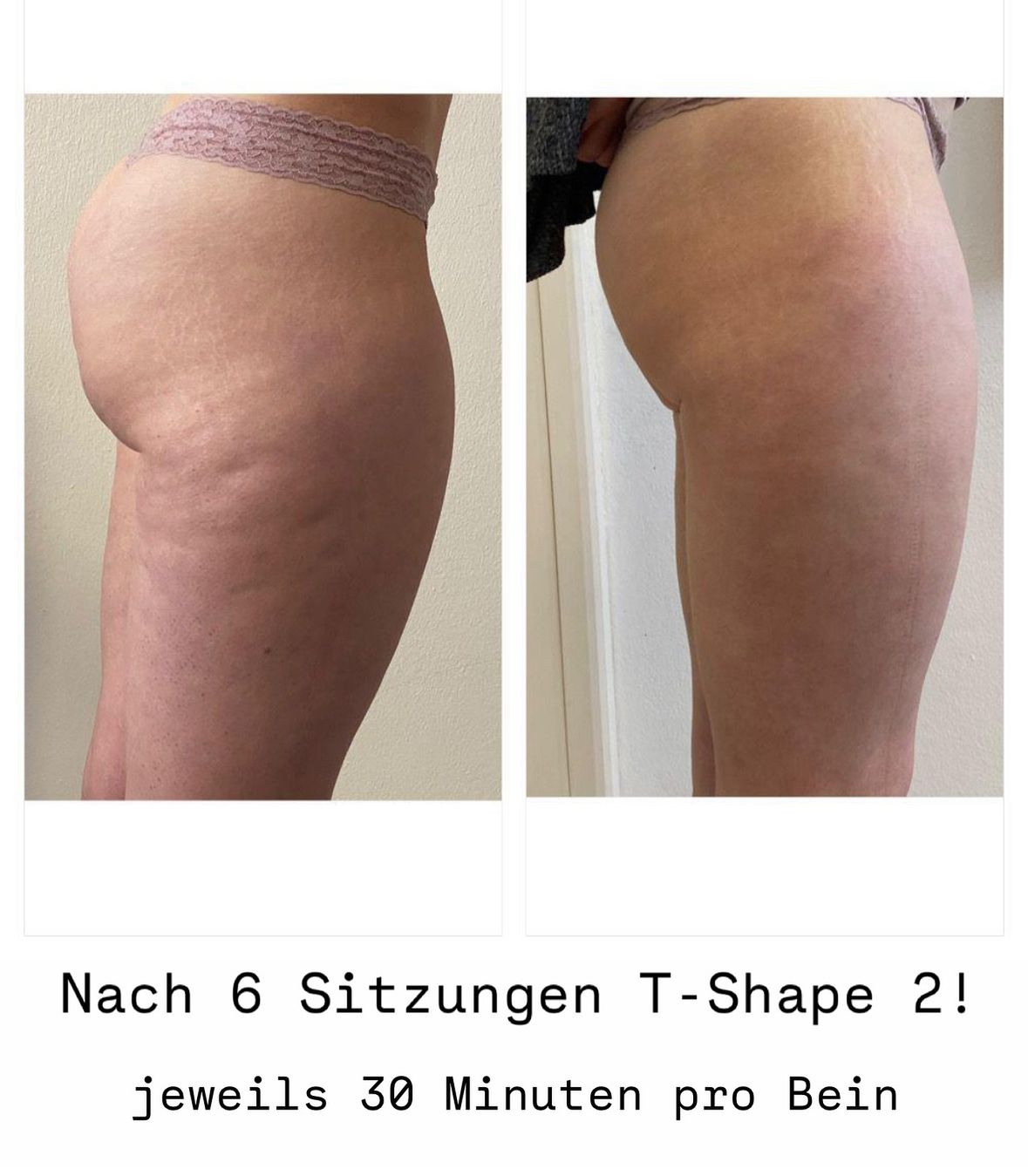 T-SHAPE 2 by BALDAN 5in1 WUNDER - NP -80000€!  - Bild 3