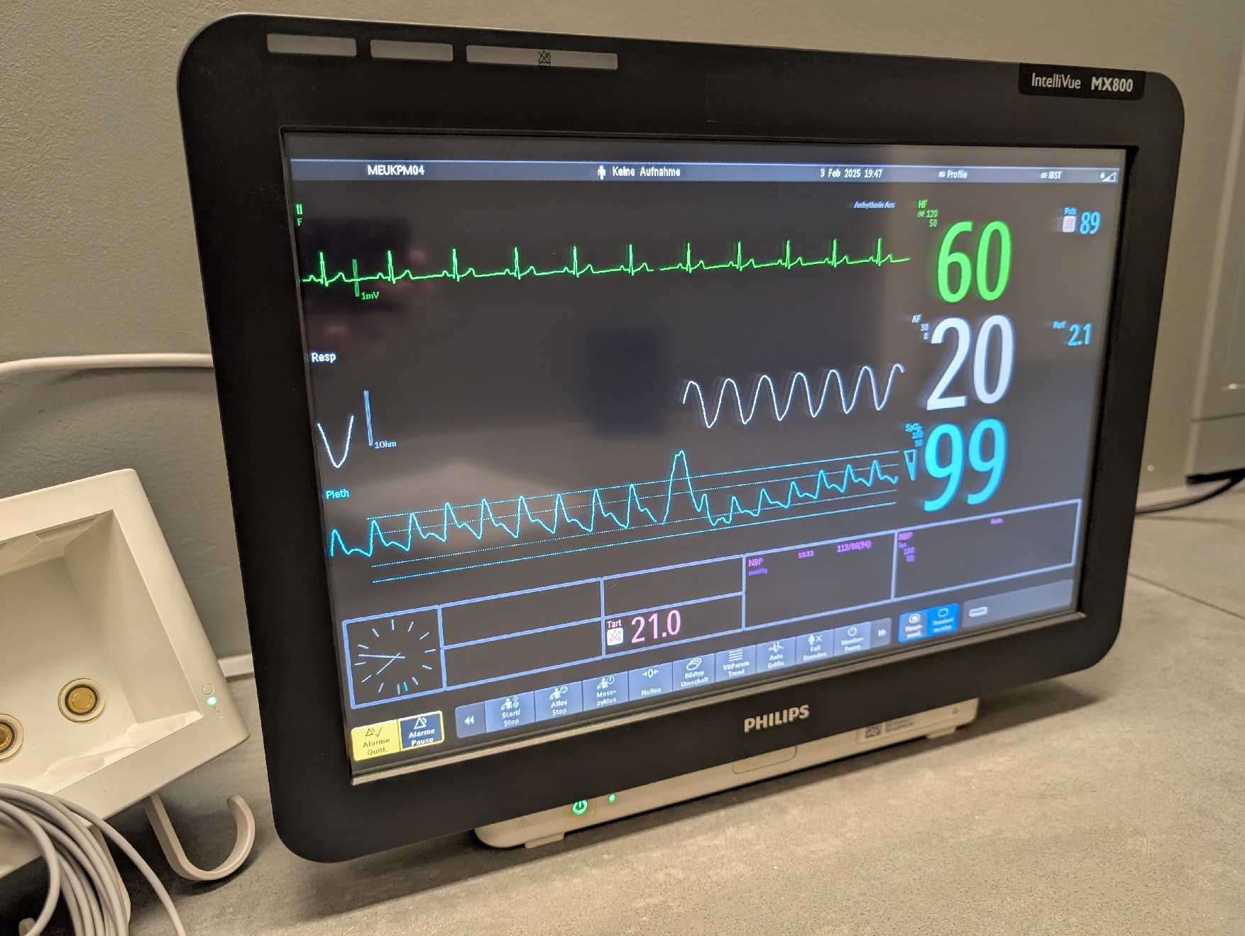 Philips MX800 IntelliVue X2 mit Prüfprotokoll - Bild 2