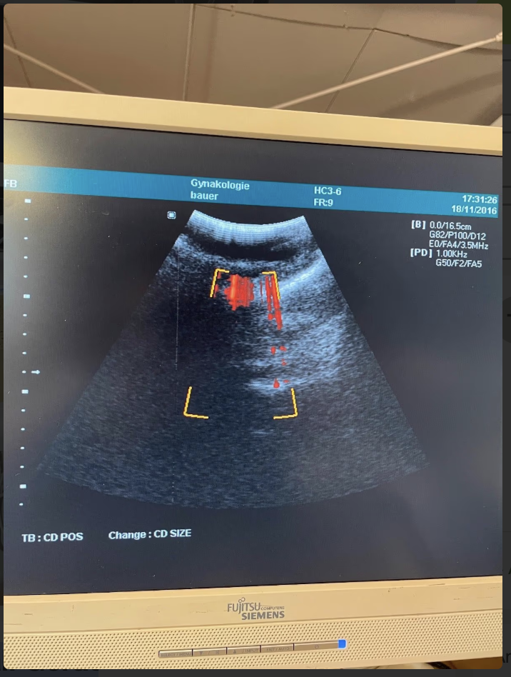 Kretz Sonoace 6000 C mit 4 Sonden Ultraschallgerät - Bild 2