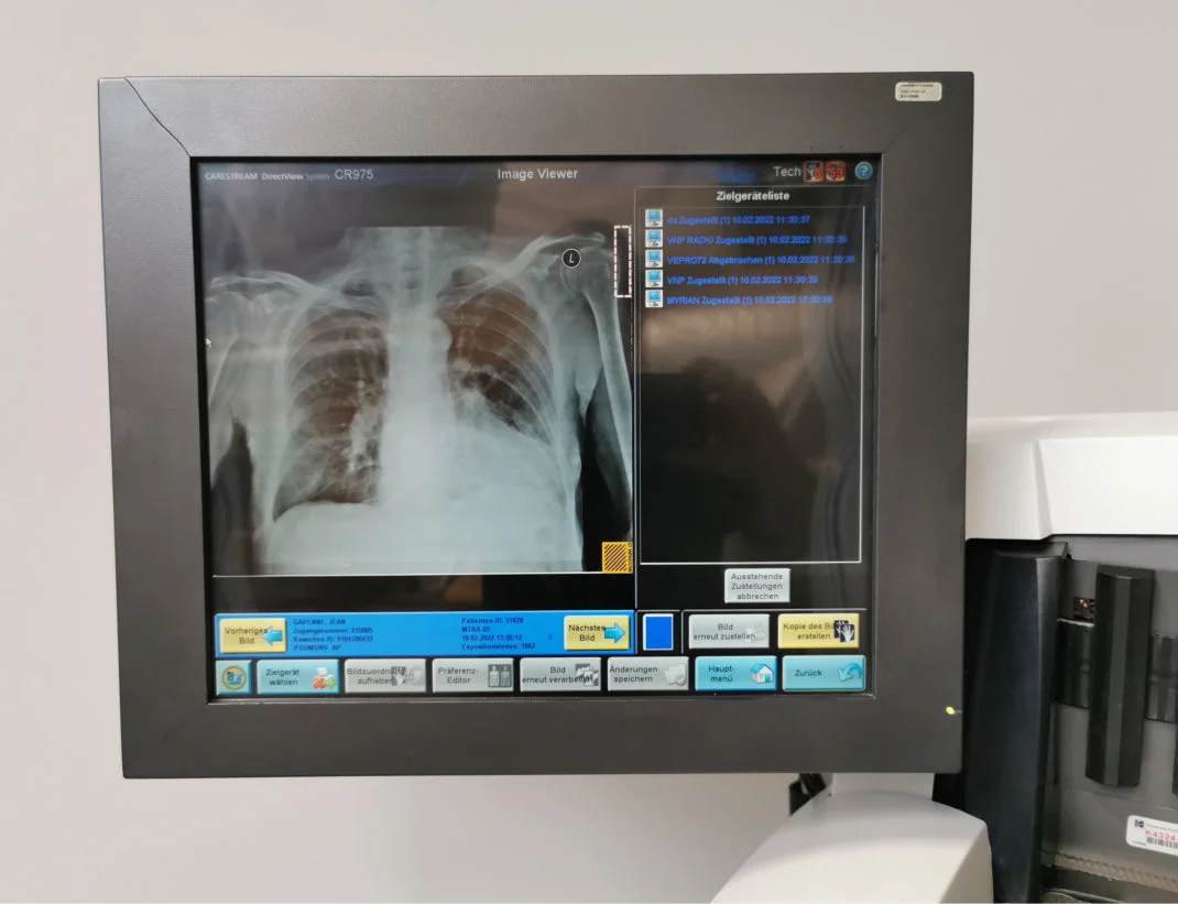 Gebraucht – Akzeptabel KODAK DirectView CR 975