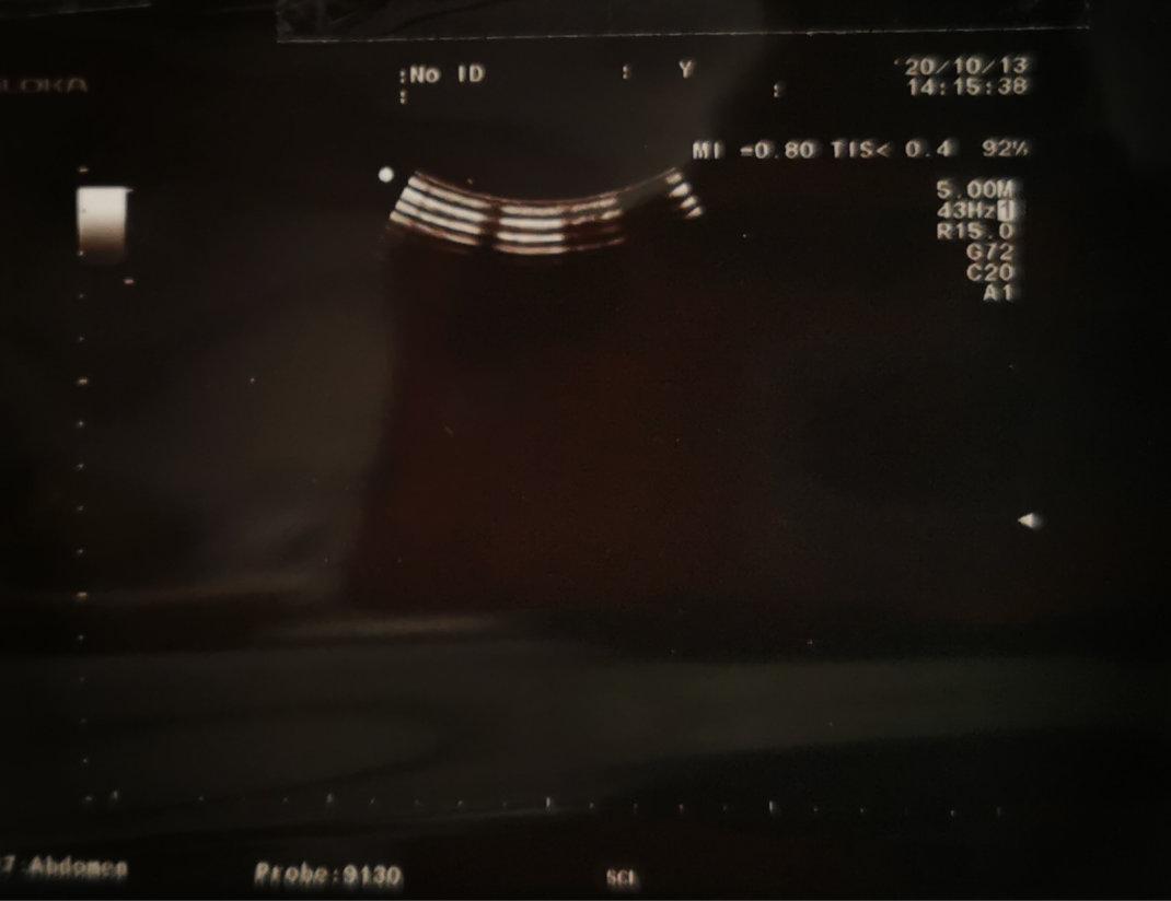 Gebraucht ALOKA UST-9130