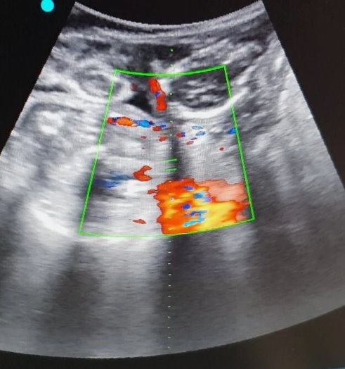 Ultraschallgeräte Mobil  SIUI Apogee 2100 Zub. - Bild 4