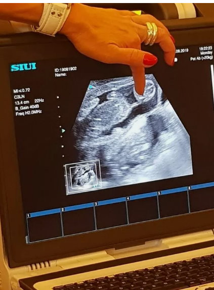 Ultraschallgeräte Mobil  SIUI Apogee 2100 Zub. - Bild 6