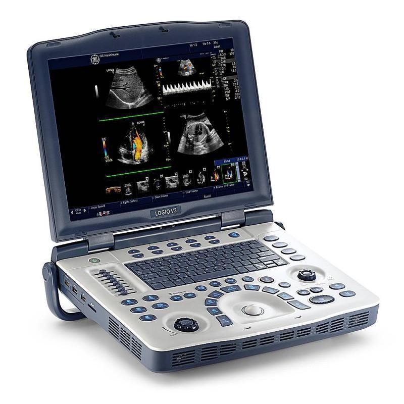 Ultraschallgerät GE Logiq V2 wie neu