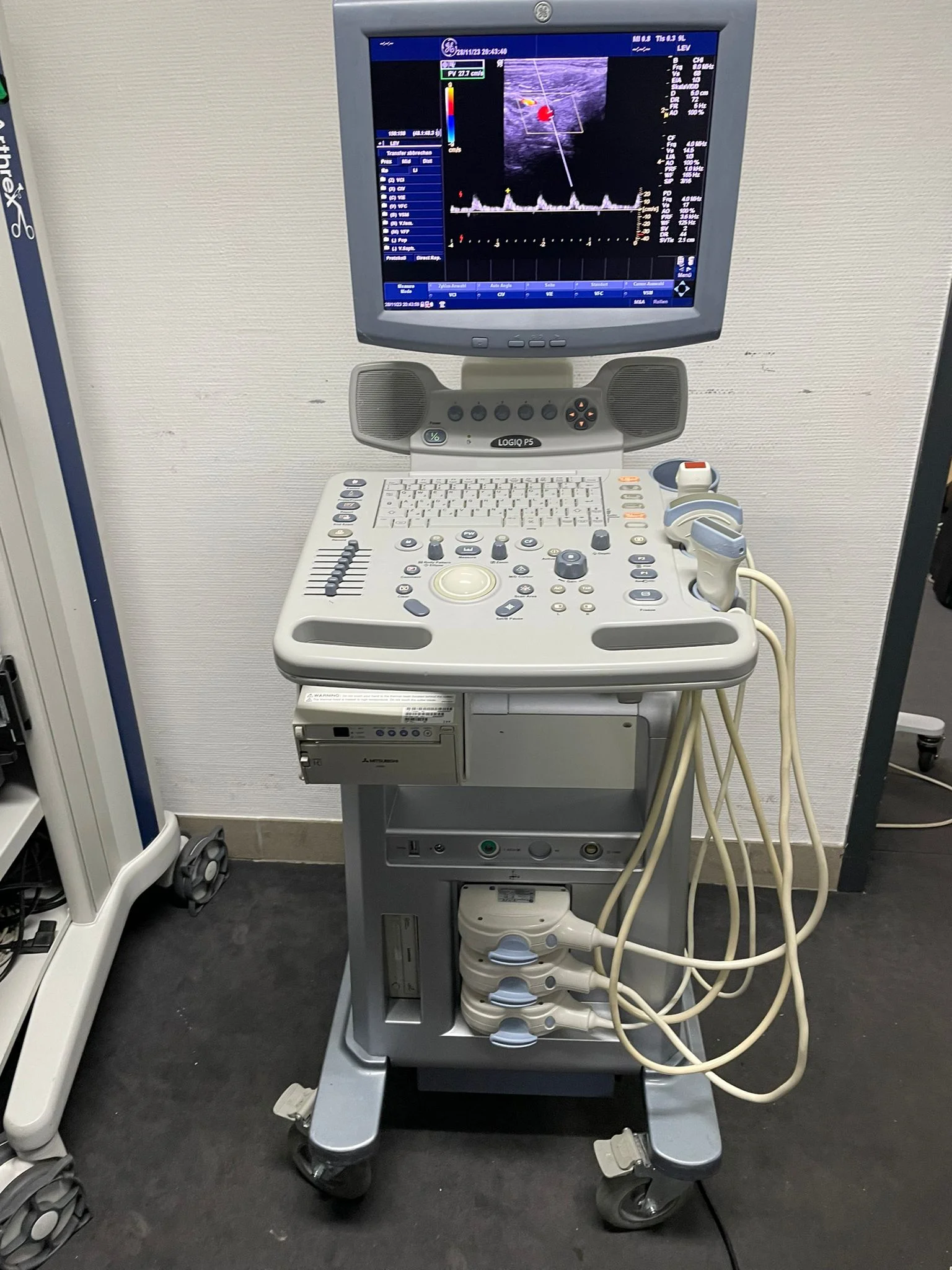 Gebraucht – Gut 2011 GE Logiq P5