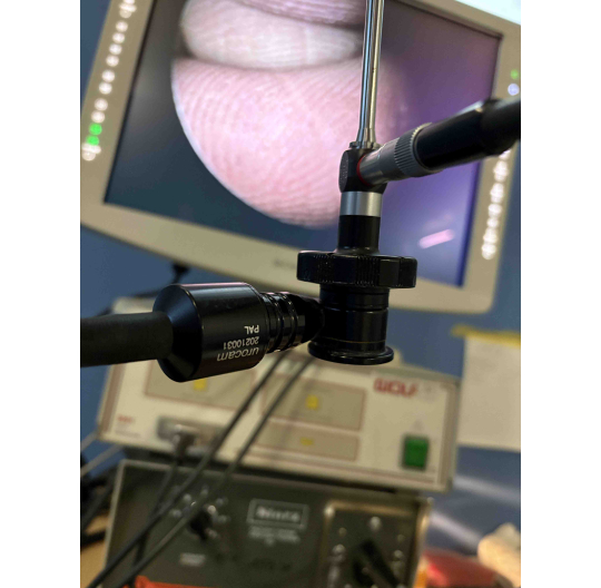 STORZ Telecam 20210031 PAL