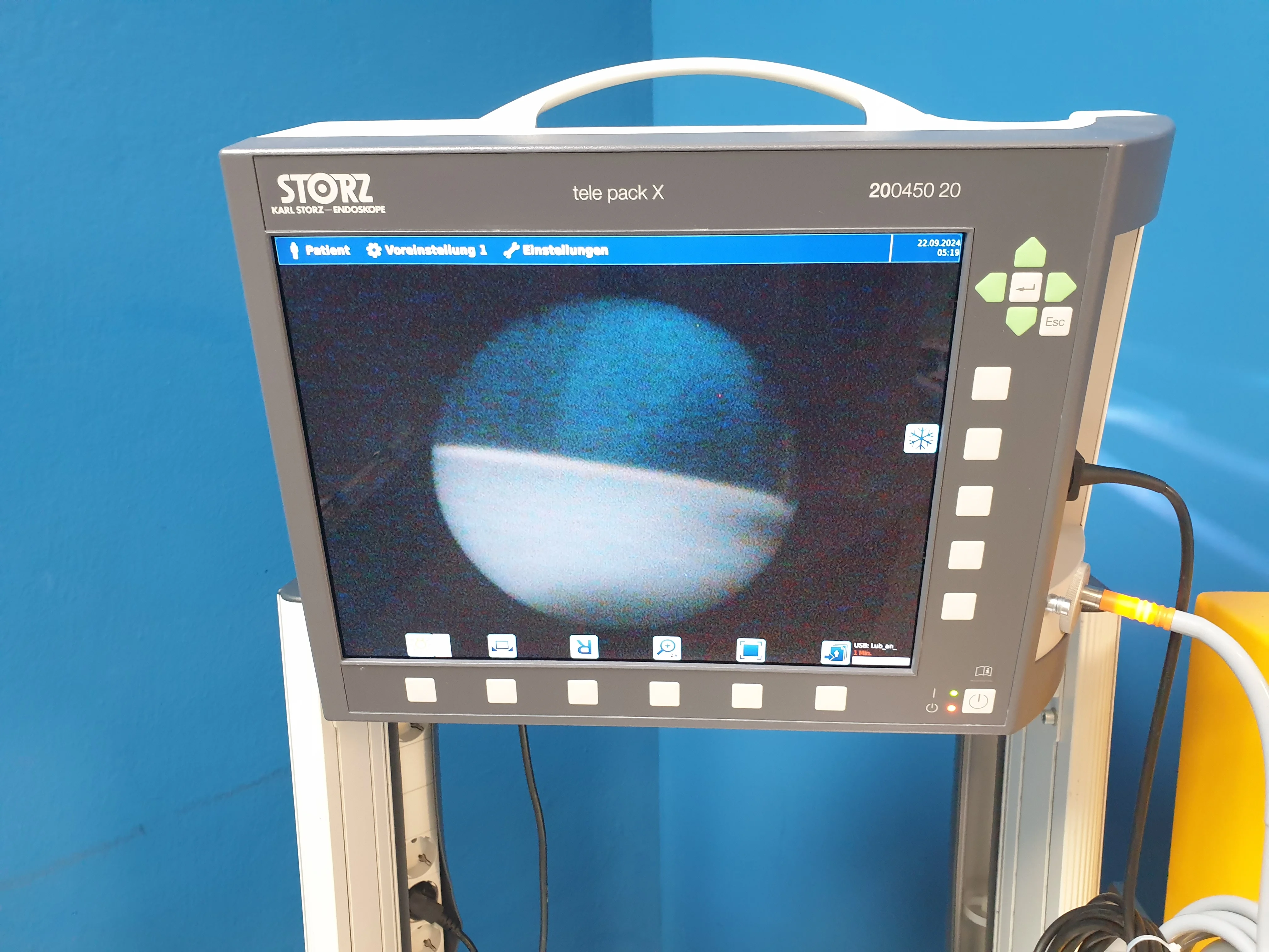 Gebraucht – Sehr Gut KARL STORZ tele pack X 200450 20